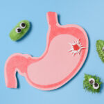 Small Intestinal Bacterial Overgrowth (SIBO) ve Sistemik Hastalıklarla Olası İlişkisi: Güncel Bilimsel Perspektif